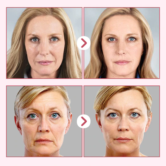 Anti Aging Face Serum - Image 7
